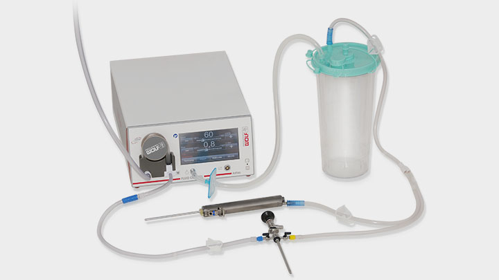Arthroscopy Fluid Management Disposables Market to be Driven by Growing Demand for Minimally Invasive Procedures and Increased Awareness of Arthroscopy procedures in the Forecast Period