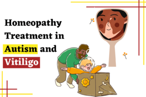 Homeopathy Treatment in Autism and Vitiligo