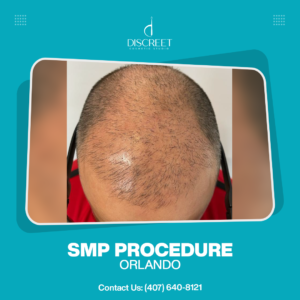 SMP Procedure Orlando