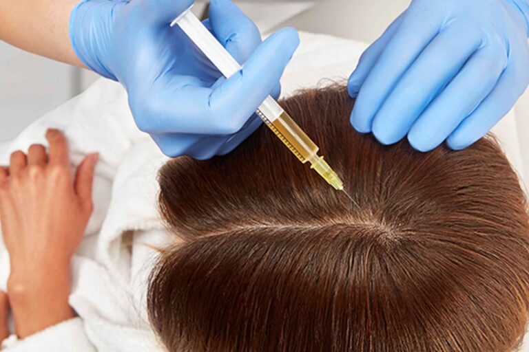 Does Prp Hair Restoration Help To Encourage Hair Growth?